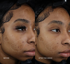 Discoloration Duo